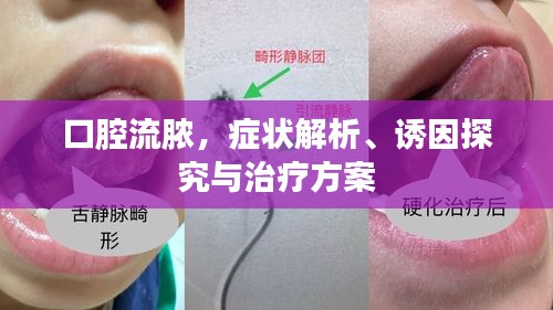 口腔流膿，癥狀解析、誘因探究與治療方案