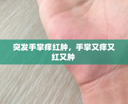 突發(fā)手掌癢紅腫，手掌又癢又紅又腫 
