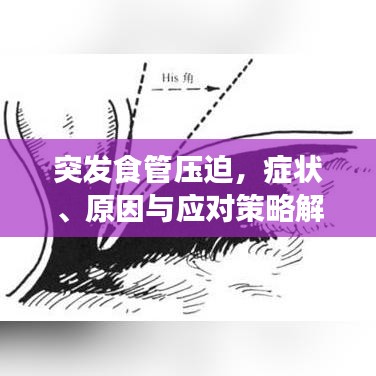 突發(fā)食管壓迫，癥狀、原因與應對策略解析